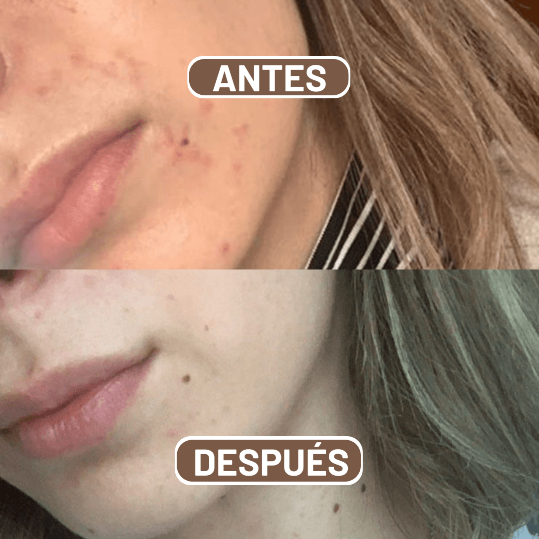 NK Limpiador Facial - Recupera tu piel brillante.